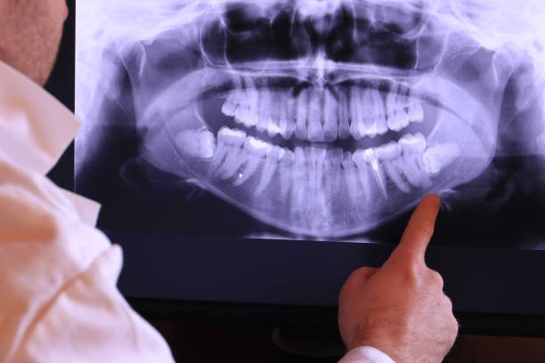 Vassar, MI Emergency Dentist Pros